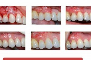 Will Gums Heal? How Food Affects Healing Gums Safem Fabrication - Precision Engineering & Custom Manufacturing Solutions Will Gums Heal? How Food Affects Healing Gums | Safem Fabrication - Precision Engineering & Custom Manufacturing Solutions