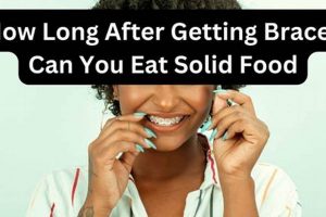 After Braces: How Long Until You Can Eat Solid Food Again? Safem Fabrication - Precision Engineering & Custom Manufacturing Solutions After Braces: How Long Until You Can Eat Solid Food Again? | Safem Fabrication - Precision Engineering & Custom Manufacturing Solutions
