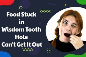 Help! Food Stuck in Wisdom Tooth Hole I Can't Get Out? World’s Most Delicious Foods: Must-Try Dishes from Every Country Help! Food Stuck in Wisdom Tooth Hole I Can't Get Out? | World’s Most Delicious Foods: Must-Try Dishes from Every Country