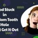 Help! Food Stuck in Wisdom Tooth Hole I Can't Get Out? | World’s Most Delicious Foods: Must-Try Dishes from Every Country